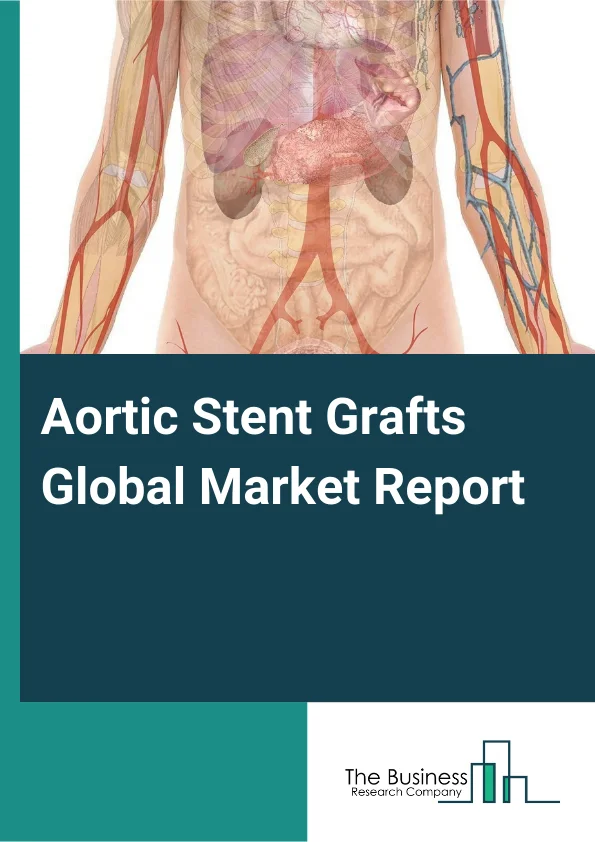 Aortic Stent Grafts