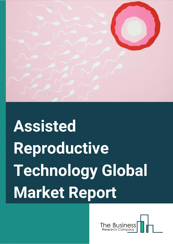 Assisted Reproductive Technology Global Market Report 2023 – By Diagnosis (Ovulation Testing Hysterosalpingography Ovarian Reserve Testing Genetic Testing), By Procedure Type (Fresh Non Donor Fresh Donor Frozen Donor Frozen Non Donor Embryo Or Egg Banking), By End User (Hospitals Fertility Clinics Other End Users) – Market Size, Trends, And Global Forecast 2023-2032