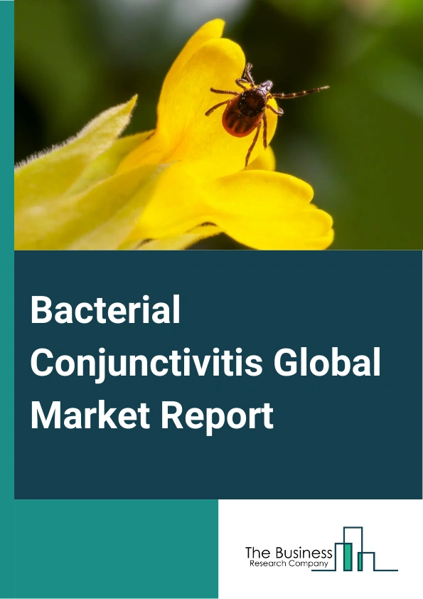 Bacterial Conjunctivitis