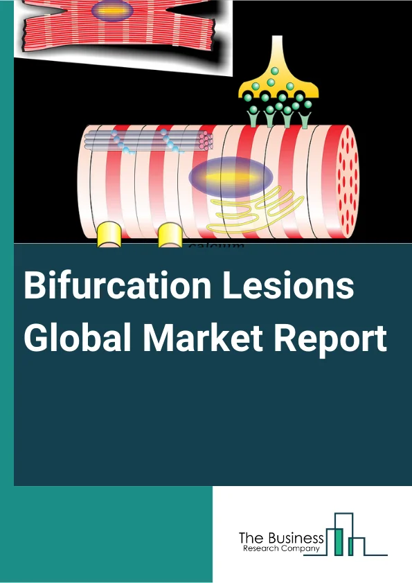 Bifurcation Lesions Global Market Report 2024 – By Types (One-Stent, Two-Stent), By Application (Coronary Vascular, Peripheral Vascular) – Market Size, Trends, And Global Forecast 2024-2033