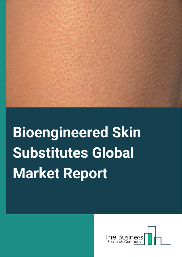 Bioengineered Skin Substitutes