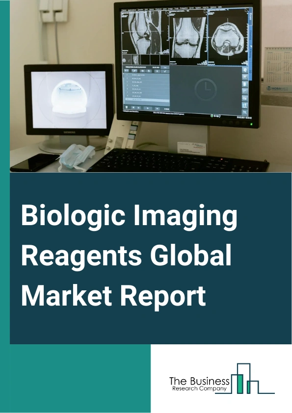 Biologic Imaging Reagents Global Market Report 2024 – By Product (Contrast Reagents, Optical Imaging Reagents, Radiopharmaceuticals), By Modality (Magnetic Resonance Imaging (MRI), Ultrasound, X-Ray And Computerized Tomography (CT), Nuclear, Optical Imaging, Other Modalities), By Application (In Vitro, In Vivo), By End User (Diagnostic Laboratories, Imaging Centers, Life Science Companies, Research And Academic Institutes, Other End Users) – Market Size, Trends, And Global Forecast 2024-2033