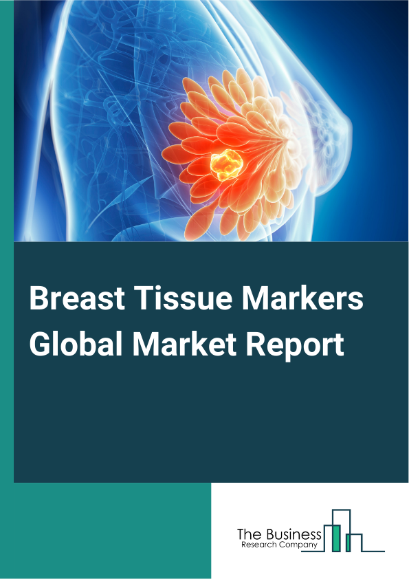 Breast Tissue Markers