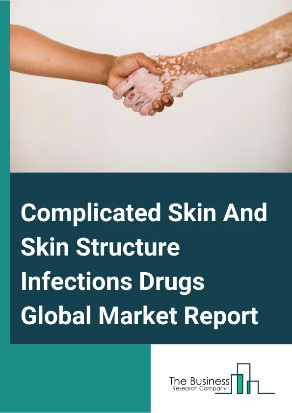 Complicated Skin And Skin Structure Infections Drugs Global Market Report 2024 – By Active Ingredients (Delafloxacin, Vancomycin, Ceftaroline Fosamil, Linezolid, Other Active Ingredients), By Route of Administration (Oral, Topical, Parenteral), By End User (Hospitals, Homecare, Specialty Clinics, Other End-Users) – Market Size, Trends, And Global Forecast 2024-2033