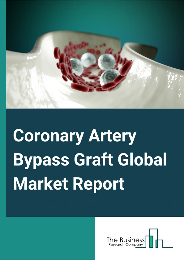 Coronary Artery Bypass Graft Global Market Report 2024 – By Procedure (Single Coronary Artery Bypass Graft (CABG) Surgery, Double Coronary Artery Bypass Graft (CABG) Surgery, Triple Coronary Artery Bypass Graft (CABG) Surgery, Quadruple Coronary Artery Bypass Graft (CABG) Surgery, Other Procedures), By Method (Off-pump, On-pump), By End-Use (Hospitals, Cardiology Clinics, Research Institutes, Other End-Users) – Market Size, Trends, And Global Forecast 2024-2033