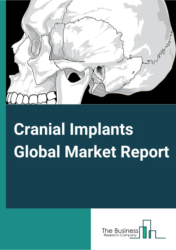 Cranial Implants Global Market Report 2024 – By Type (Customized Cranial Implants, Non-customized Cranial Implants), By Material (Polymer, Ceramic, Metal), By End User (Hospital and Trauma Centers, Ambulatory Surgical Centers, Specialty Clinics, Other End-Users ) – Market Size, Trends, And Global Forecast 2024-2033