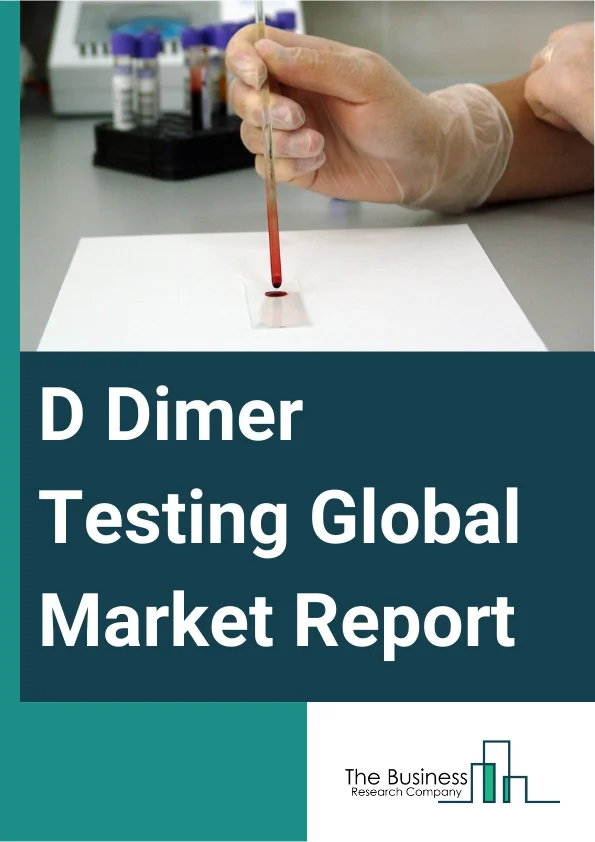 D Dimer Testing