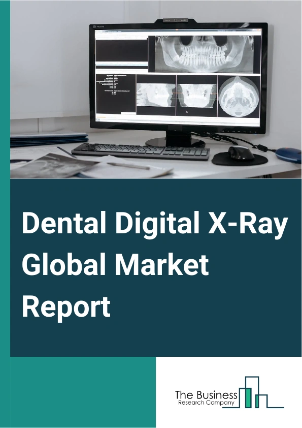 Dental Digital X Ray