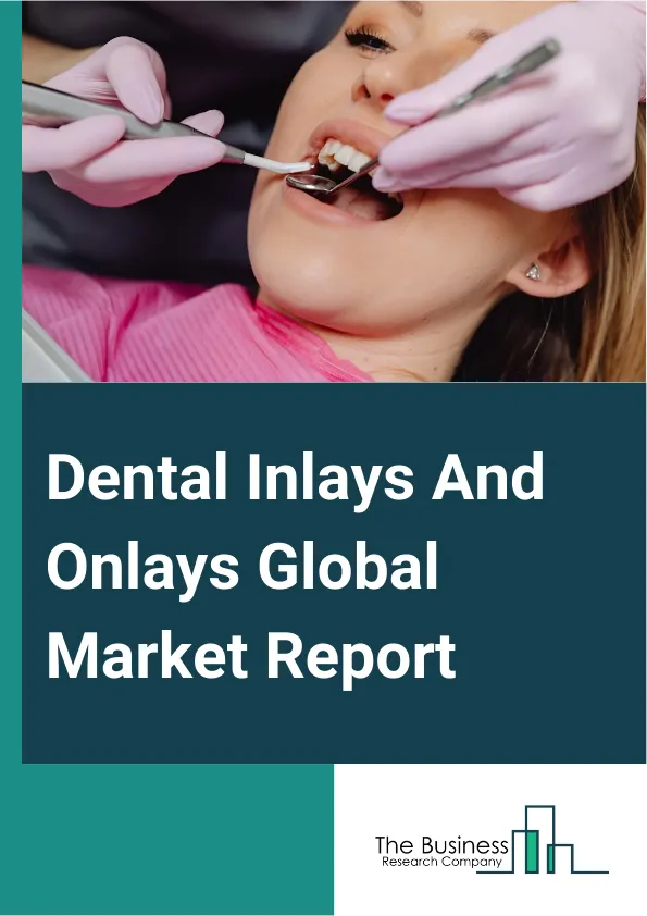 Dental Inlays And Onlays