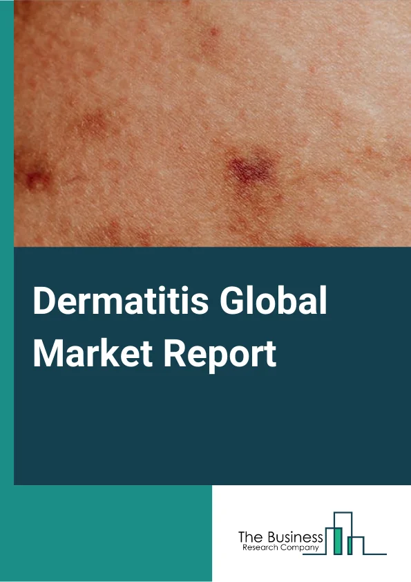 Dermatitis Global Market Report 2024 – By Drug Class (Corticosteroids, Emollients/Moisturizers, Antihistamines, Calcineurin Inhibitors, Antibiotics, Immunomodulators, Interleukin Inhibitors ), By Distribution Channel (Hospital, Retail Pharmacies, Drug Stores, Online Or Mail Pharmacies), By Application (Cancer, Blood Disorders, Chronic Diseases, Infectious Diseases) – Market Size, Trends, And Global Forecast 2024-2033