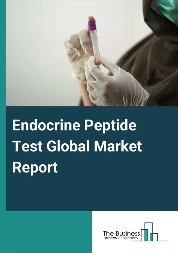 Endocrine Peptide Test Global Market Report 2024 – By Test-Type (Dehydroepiandrosterone Sulphate, Progesterone, Luteinizing Hormone, Thyroid Prolactin, Oestradiol, Human Chorionic Gonadotropin, Thyroid-Stimulating Hormone, Other Test-Types), By Technology (Mass Spectroscopy, Immunoassay, Chromatography, Nucleic Acid Based, Other Technologies), By End-User (Clinics, Healthcare Centers, Hospitals, Commercial Laboratories) – Market Size, Trends, And Global Forecast 2024-2033