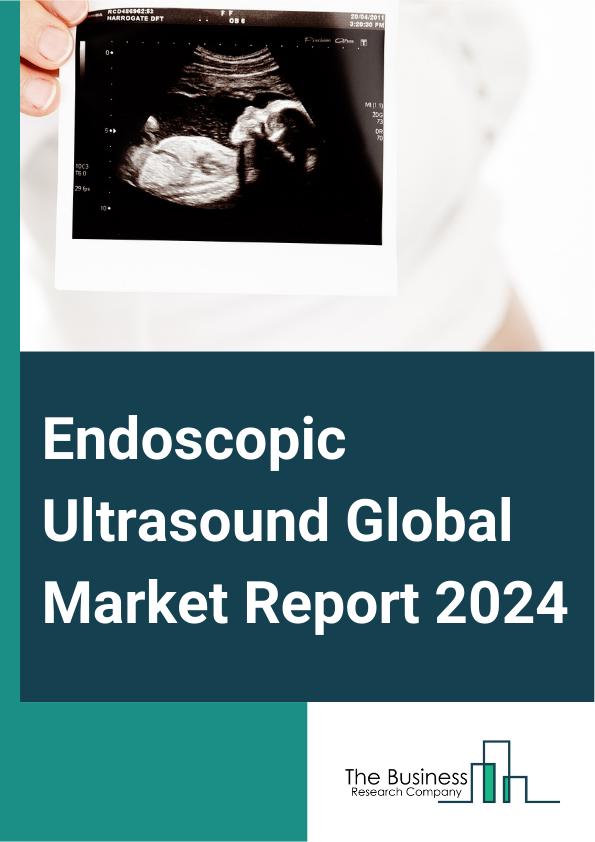 Endoscopic Ultrasound