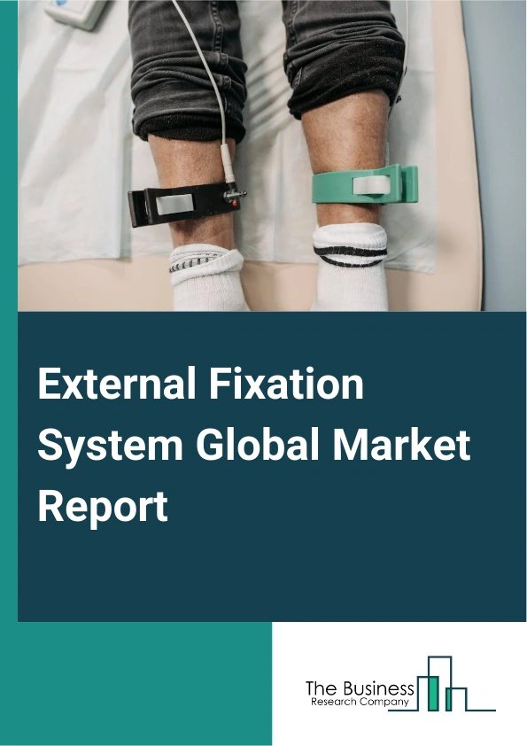 External Fixation System