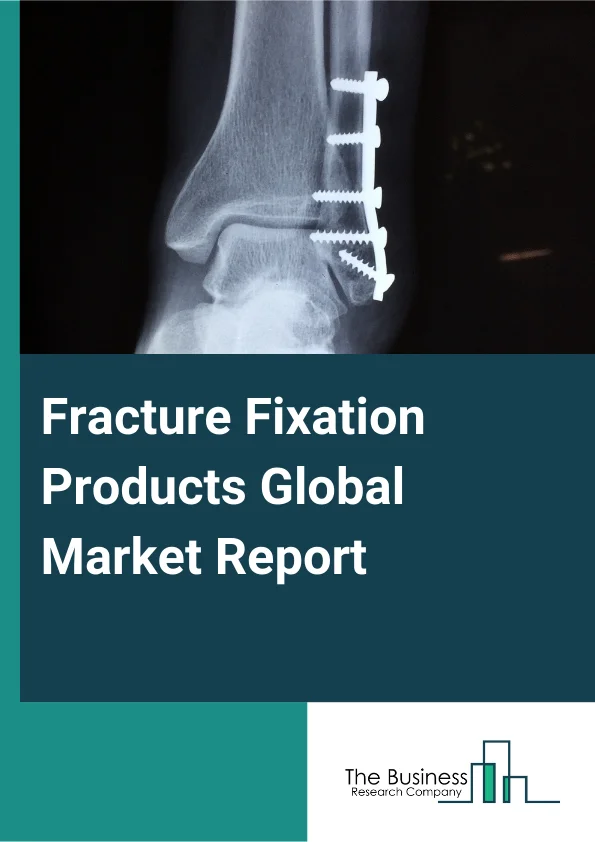 Fracture Fixation Products