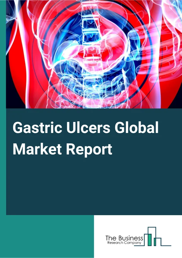 Gastric Ulcers