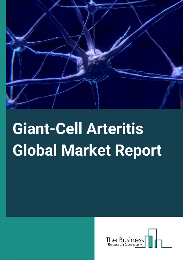 Giant Cell Arteritis