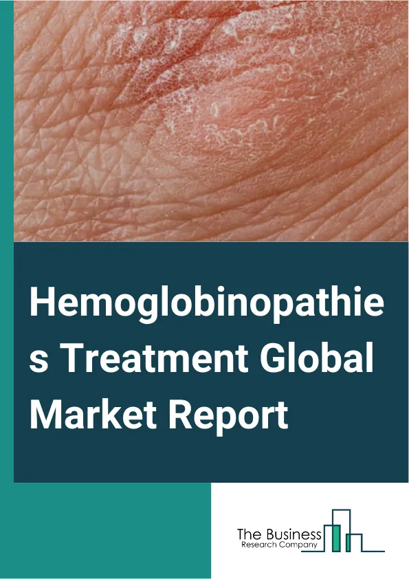 Hemoglobinopathies Treatment