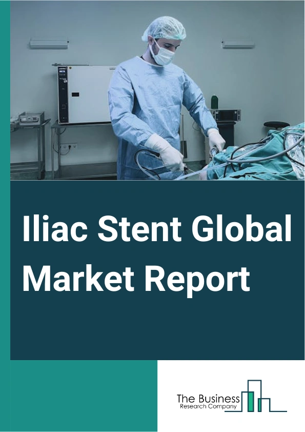 Iliac Stent