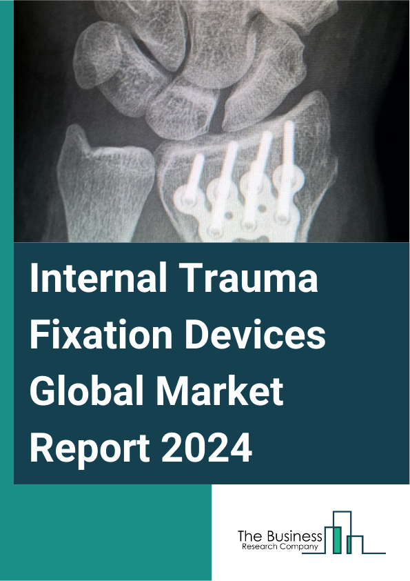 Internal Trauma Fixation Devices