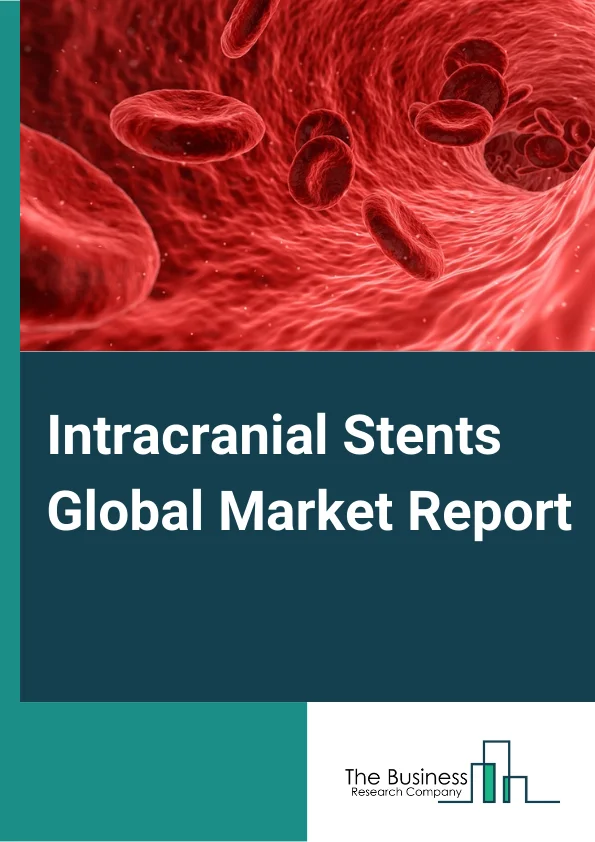 Intracranial Stents Global Market Report 2023 – By Type (Self Expanding Stents, Balloon Expanding Stents, Stent-Assisted Coil Embolization), By Disease Indication (Brain Aneurysm, Intracranial Stenosis), By End-User (Hospitals, Ambulatory Surgery Centers, Other End-Users) – Market Size, Trends, And Global Forecast 2023-2032