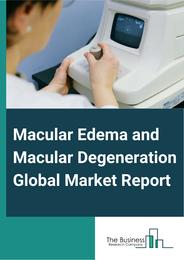 Macular Edema and Macular Degeneration