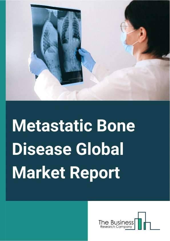 Metastatic Bone Disease