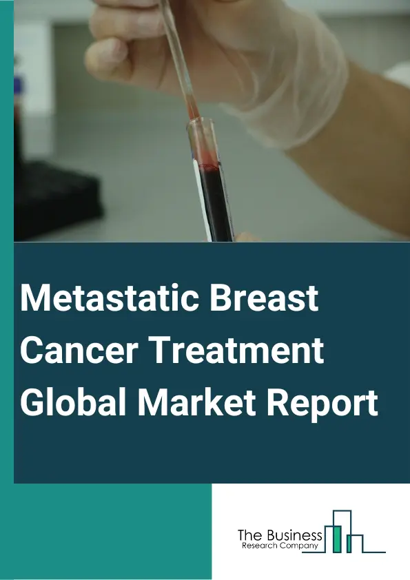 Metastatic Breast Cancer Treatment Global Market Report 2023 – By Therapy Type (Chemotherapy, Radiation Therapy, Biologic Targeted Therapy, Breast Surgery, Hormone Therapy), By Molecule Type (Monoclonal Antibody, Peptides, Polymer, Small Molecule, Gene Therapy), By Route Of Administration (Oral, Parenteral), By End-User (Hospitals, Clinics, Ambulatory Surgical Centers, Other End-Users) – Market Size, Trends, And Global Forecast 2023-2032