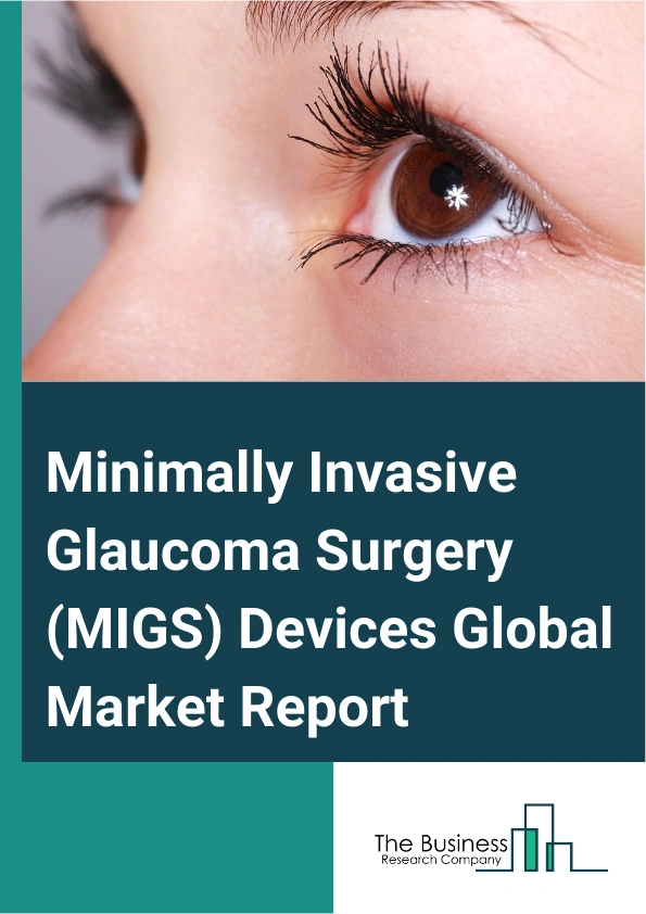 Minimally Invasive Glaucoma Surgery MIGS Devices