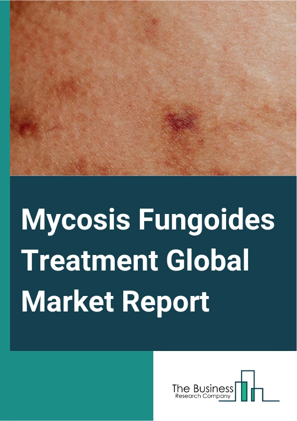 Mycosis Fungoides Treatment