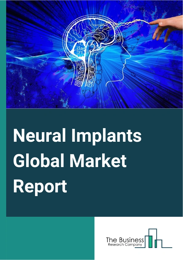 Neural Implants