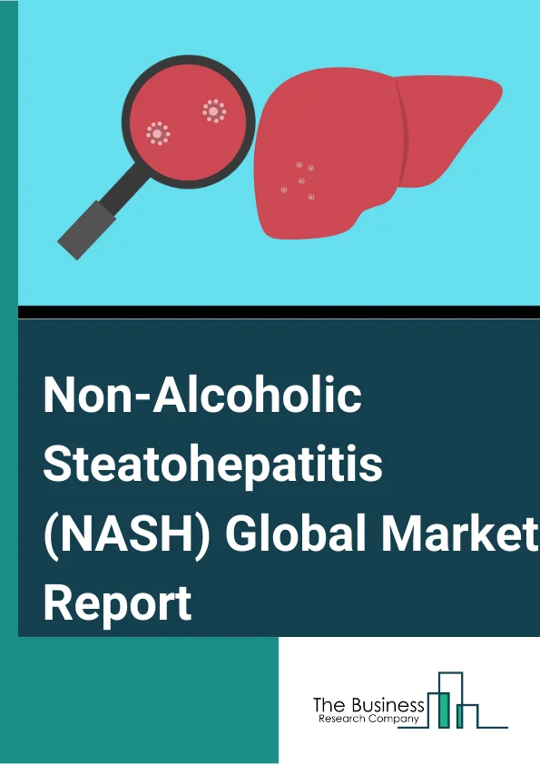 Non-Alcoholic Steatohepatitis (NASH) Global Market Report 2024 – By Type (Solid, Liquid), By Product (Vitamin E and Pioglitazone, Ocaliva, Elafibranor, Selonsertib and Cenicriviroc, Other Products), By Disease Cause (Hypertension, Heart Disease, High Blood Lipid, Type 2 Diabetes, Obesity), By Sales Channel (Hospital Pharmacy, Retail Pharmacy, Online Provider), By Application (Oral, Parenteral) – Market Size, Trends, And Global Forecast 2024-2033