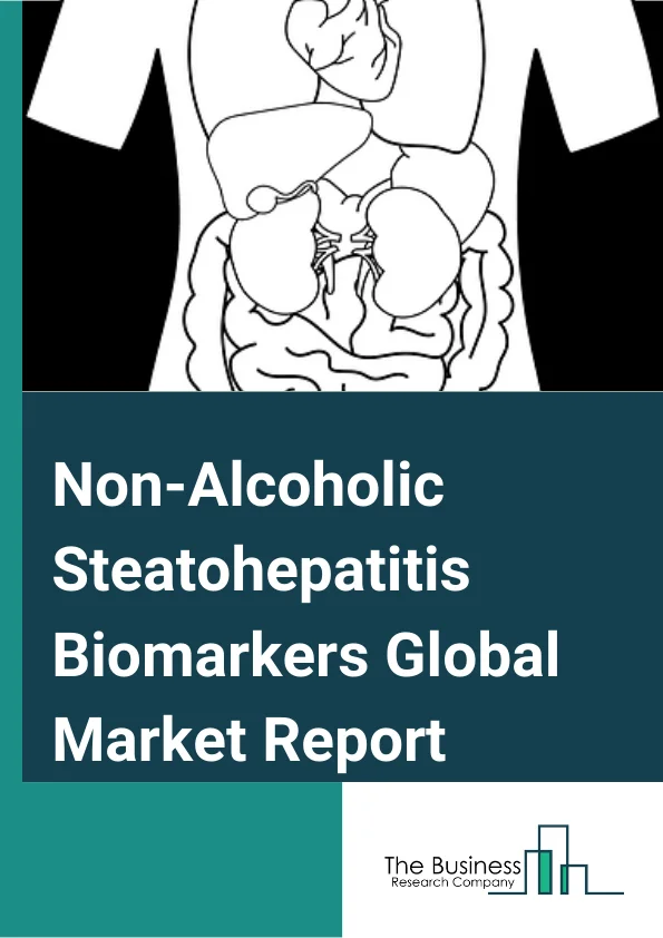 Non-Alcoholic Steatohepatitis Biomarkers Global Market Report 2024 – By Type (Hepatic Fibrosis Biomarkers, Serum Biomarkers, Oxidative Stress Biomarkers, Apoptosis Biomarkers, Other Types), By Disease (Hypertension, Heart Disease, High Blood Lipid, Type 2 Diabetes, Obesity), By End Use (Research Institutes And Academics, Diagnostic Centers, Pharmaceutical Companies And Pharmaceutical Companies And Contract Research Organizations (CROs), Hospitals And Clinics, Other End-Uses) – Market Size, Trends, And Global Forecast 2024-2033