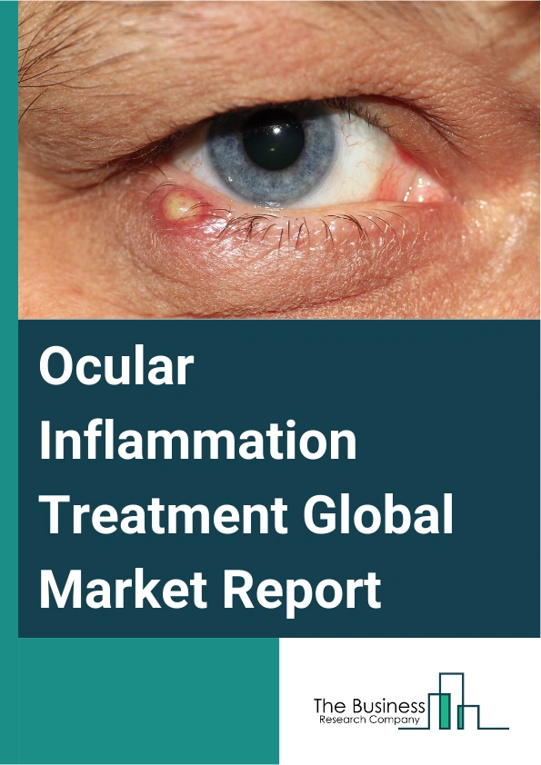 Ocular Inflammation Treatment