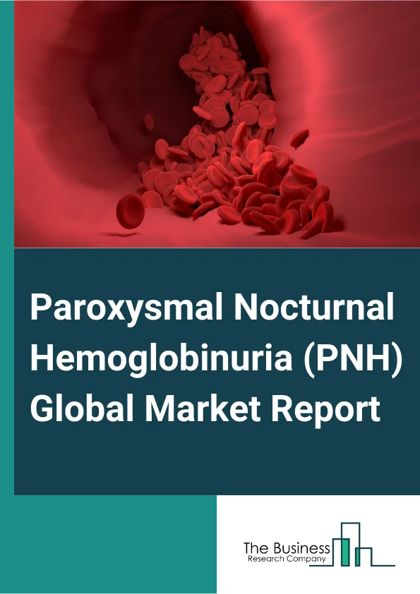 Paroxysmal Nocturnal Hemoglobinuria (PNH) Global Market Report 2024 – By Treatment Type (Medications, Bone Marrow Transplantation, Blood Transfusion, Immunosuppressive Therapy, Other Treatment Types), By Diagnosis Type (Flow Cytometry, High-Resolution Mass Spectrometry, Other Diagnosis Types), By End Use (Hospitals, Clinics, Other End Users) – Market Size, Trends, And Global Forecast 2024-2033