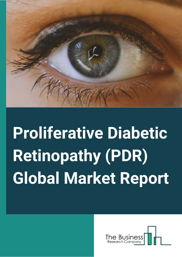 Proliferative Diabetic Retinopathy (PDR) Global Market Report 2024 – By Treatment Type (Anti-VEGF (Vascular Endothelial Growth Factor) Therapy, Intraocular Steroids, Laser Surgery, Vitrectomy), By Mode of Administration (Injectables, Oral, Other Mode Of Administrations), By Application (Hospitals, Clinics, Other Applications) – Market Size, Trends, And Global Forecast 2024-2033