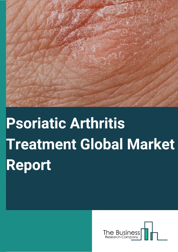 Psoriatic Arthritis Treatment Global Market Report 2024 – By Drug Class (Nonsteroidal Anti-Inflammatory Drugs (NSAIDS), Disease-Modifying Anti-Rheumatic Drugs (DMARDS), Biologics, Other Drug Classes), By Route Of Administration (Oral, Parenteral, Topical), By Distribution Channel (Hospital Pharmacies, Retail Pharmacies, Online Pharmacies) – Market Size, Trends, And Global Forecast 2024-2033