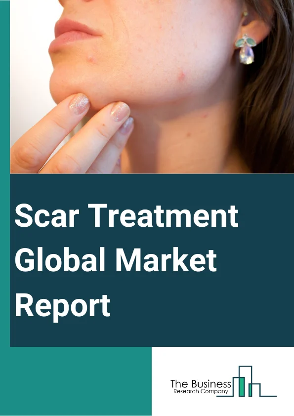 Scar Treatment Global Market Report 2024 – By Scar Type (Atrophic Scars, Hypertrophic And Keloid Scars, Contracture Scars, Other Scar Types), By Treatment Type (Topical, Laser, Surface, Surgical, Injectable), By End User (Hospitals, Clinics, Pharmacies and Drug Store, E-commerce) – Market Size, Trends, And Global Forecast 2024-2033