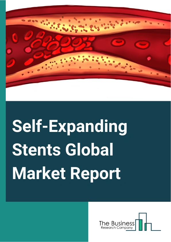 Self-Expanding Stents Global Market Report 2024 – By Product Type (Gastrointestinal Self-Expanding Stents, Carotid Self-Expanding Stents, Endovascular Self-Expandable Stents, Other Product Types), By Applications (Fem-Pop Artery Stents, Iliac Artery Stents, Carotid Artery Stents, Biliary Stents, Other Applications), By End-Users (Hospitals, Ambulatory Surgical Centers, Other End-Users) – Market Size, Trends, And Global Forecast 2024-2033