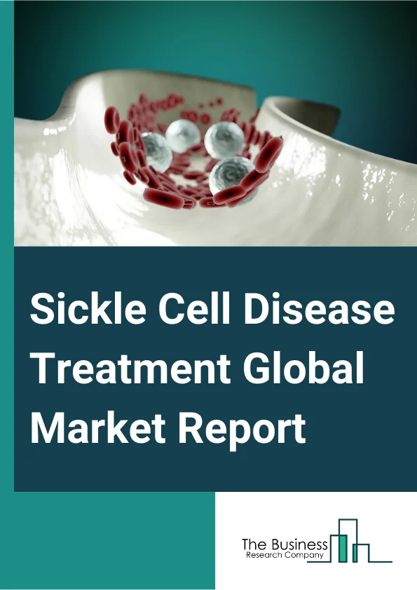 Sickle Cell Disease Treatment Global Market Report 2024 – By Treatment Modality (Blood Transfusion, Pharmacotherapy, Bone Marrow Transplant), By Disease Type (Sickle Cell Anemia, Hemoglobin Sickle C Disease (HbSC), Other Disease Types), By Route Of Administration (Oral, Parenteral), By End-User (Hospitals, Specialty Clinics, Other End-Users) – Market Size, Trends, And Global Forecast 2024-2033