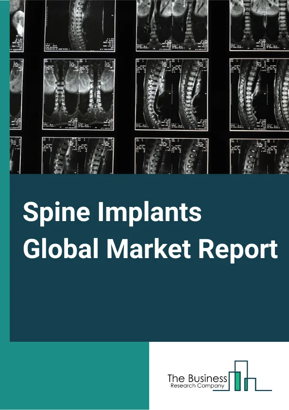 Spine Implants