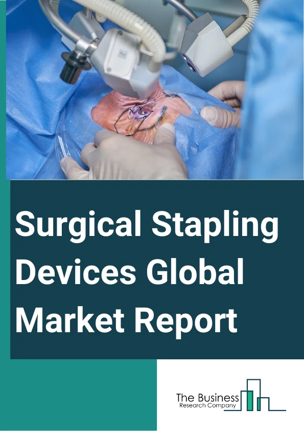 Surgical Stapling Devices
