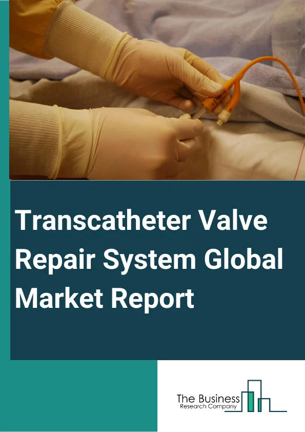 Transcatheter Valve Repair System Global Market Report 2024 – By Product Type (Transcatheter Aortic Valve Replacement (TAVR), Transcatheter Mitral Valve Replacement (TMVR), Transcatheter Pulmonary Valve Replacement (TPVR), Transcatheter Tricuspid Valve Replacement (TTVR)), By Application (Aortic Stenosis, Mitral Stenosis, Tricuspid Stenosis, Pulmonary Stenosis), By End-user (Hospitals, Specialty Clinics, Ambulatory Surgical Centers, Other End-Users) – Market Size, Trends, And Global Forecast 2024-2033