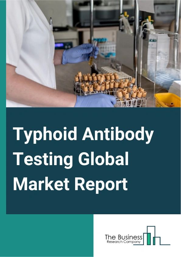 Typhoid Antibody Testing