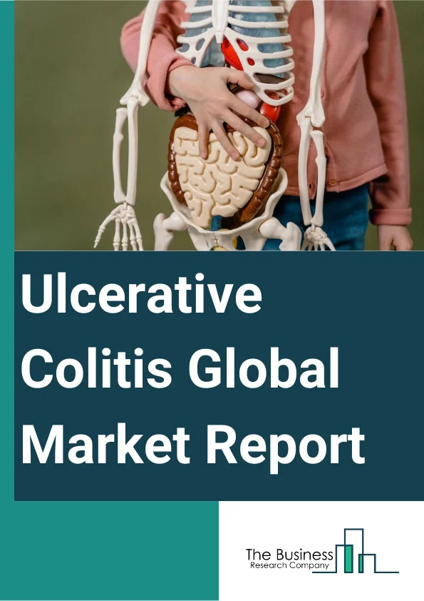 Ulcerative Colitis Market Size, Opportunities And Scope By 2033