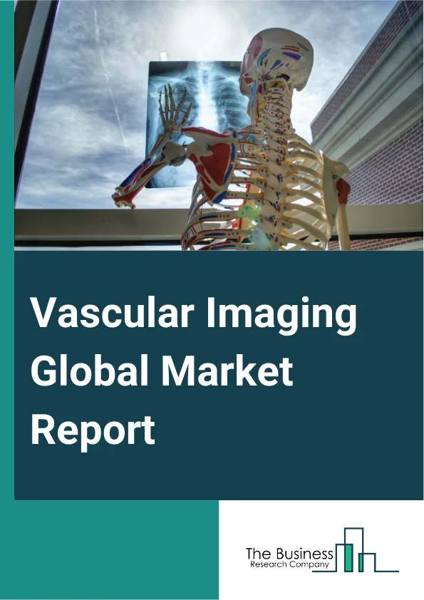 Vascular Imaging