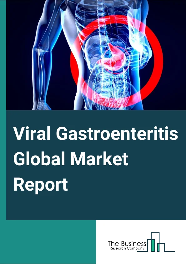 Viral Gastroenteritis Global Market Report 2024 – By Drugs (Antibiotics, Antacids, Laxatives, Antimotility Agents, Others Drugs), By Diagnosis (Physical Examination, Rapid Stool Test), By Indication (Watery Diarrhea, Abdominal Cramps, Pain, Other Indications), By Type Of Virus (Norovirus, Rotavirus, Astrovirus, Enteric Adenovirus), By End User (Hospitals, Clinics, Pharmaceutical Companies, Diagnostic Centers, Ambulatory Care Centers, Others End Users) – Market Size, Trends, And Global Forecast 2024-2033